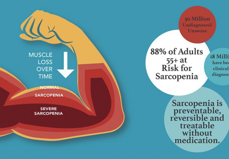 Sarcopenia and why you should care about strength
