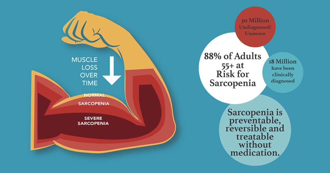 Sarcopenia and why you should care about strength
